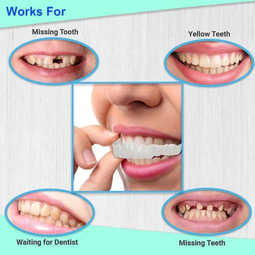 StoreTom Unisex Snap-On Veneers  | Natural Look | Instant Smile | BPA-Free| 1 pair (Uper and lower) - Image 6