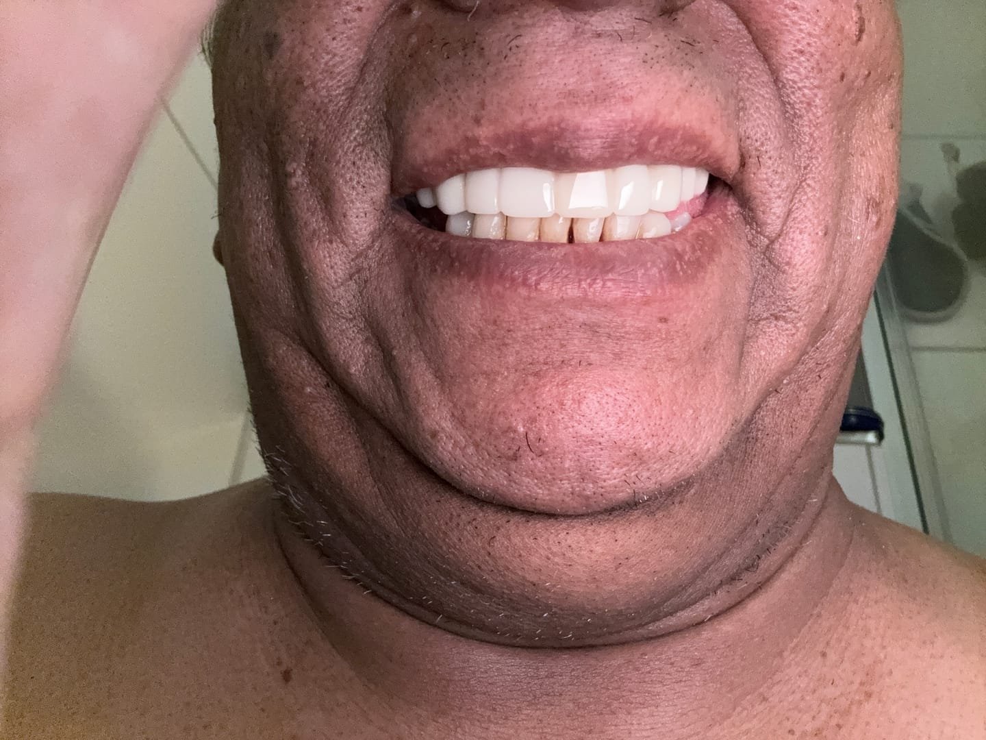 StoreTom Clip In Veneers | Snap On Veneers | 1 pair (Uper and lower) photo review