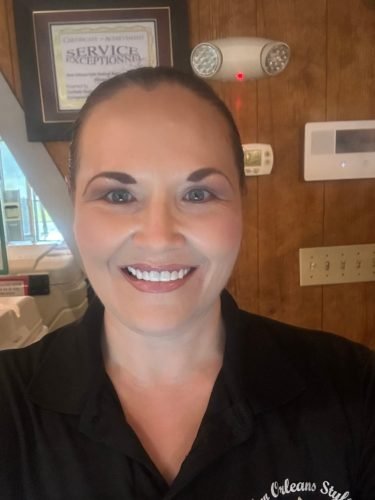 StoreTom Unisex Snap-On Veneers  | Natural Look | Instant Smile | BPA-Free| 1 pair (Uper and lower) photo review